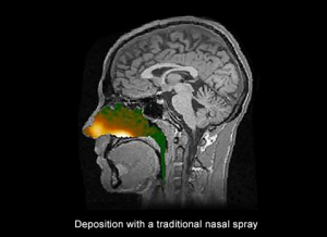 Deposition with a tradition nasal spray