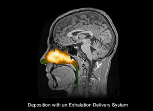 Deposition with an Exhalation Delivery System